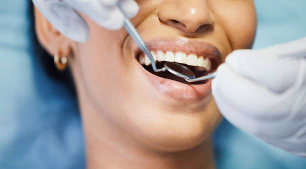 Best Weekend Emergency Dentist in Richmond Heights, OH