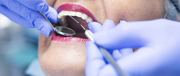 Best Emergency Dental Surgery in Richmond Heights, OH